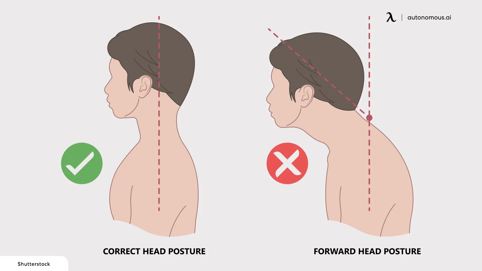 How Does Bad Posture Cause Headaches?